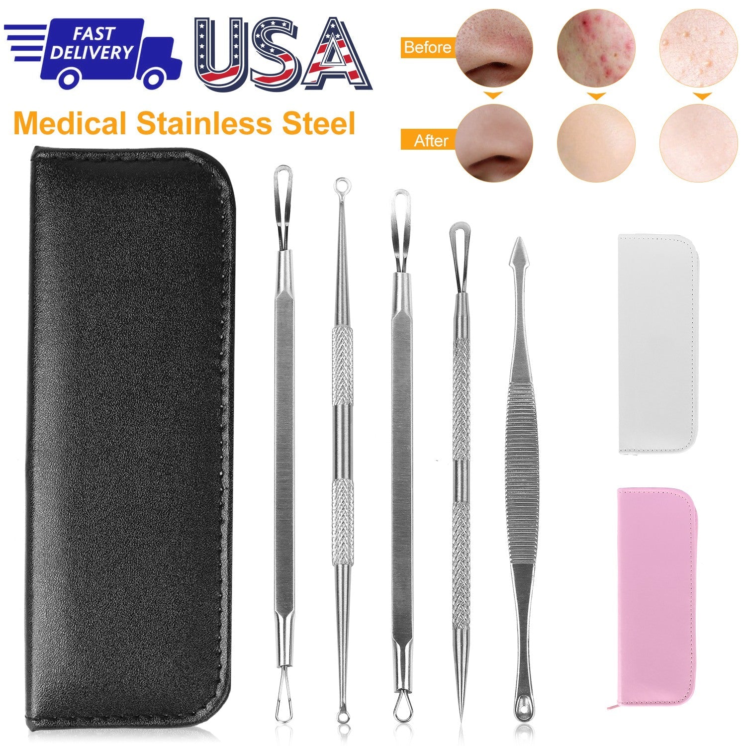 5-Piece Stainless Steel Blackhead Remover Acne Extractor Tool Set