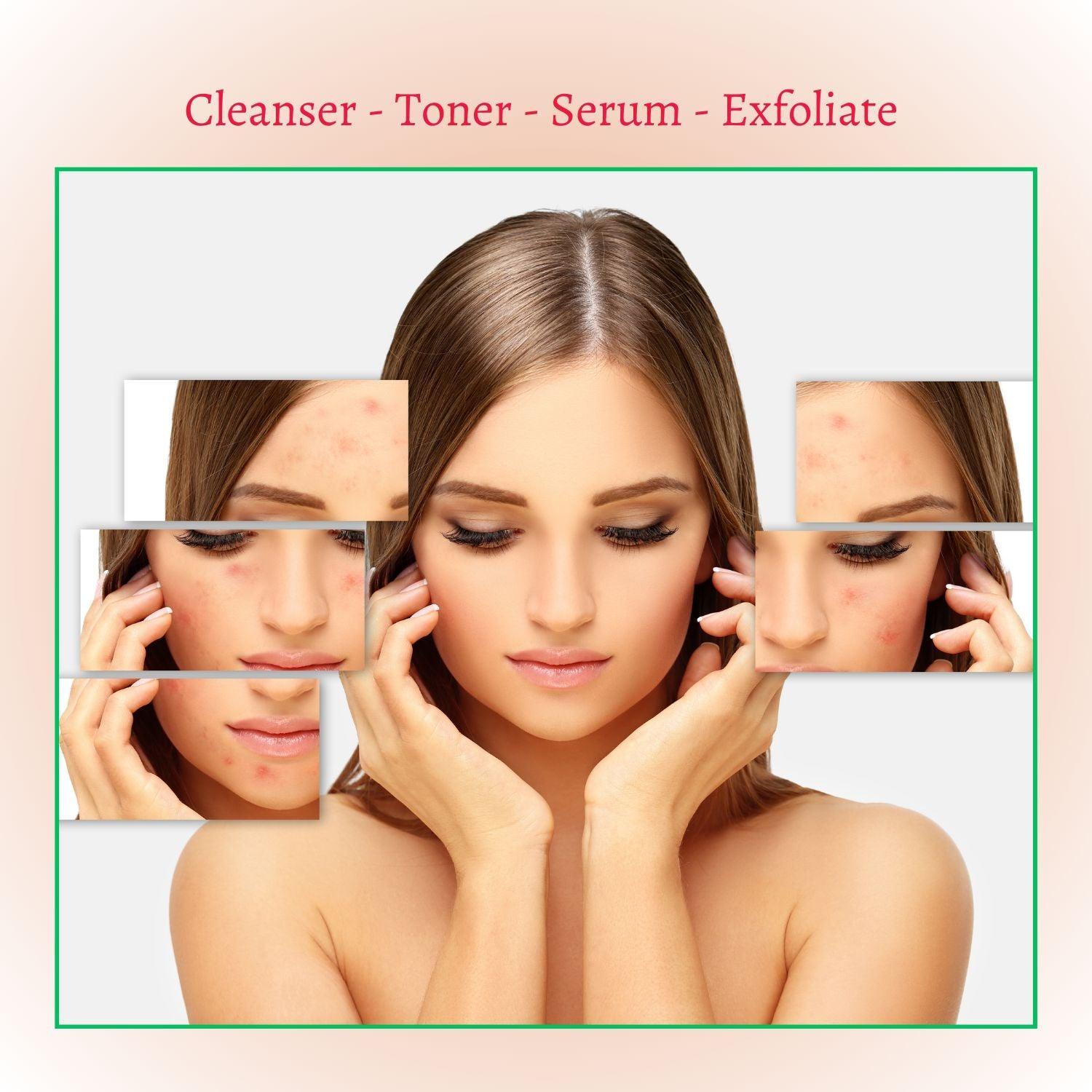 New Skin Natural Intensive Acne Serum