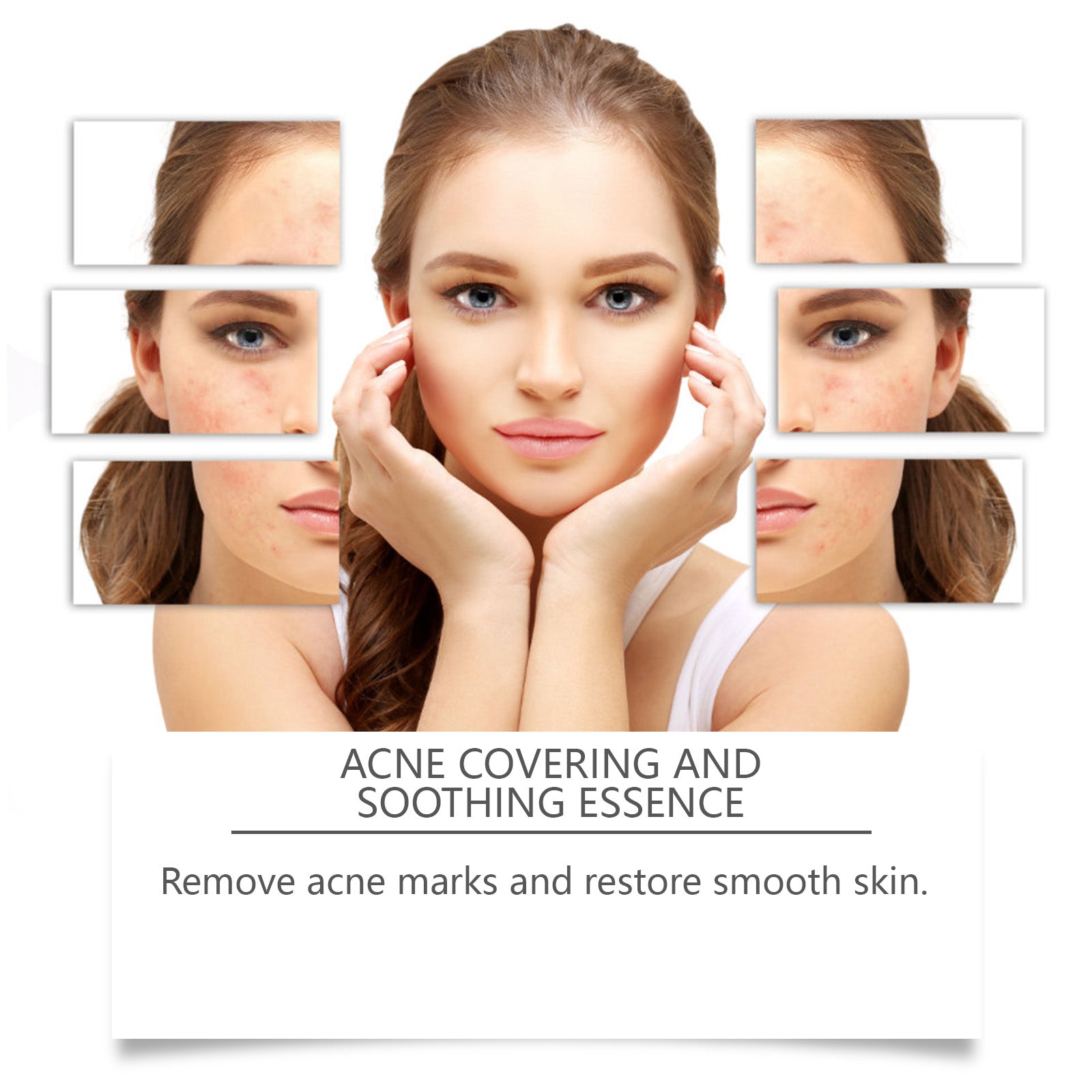 Acne Soothing Facial Serum Hydrating Gentle Skin Care Solution
