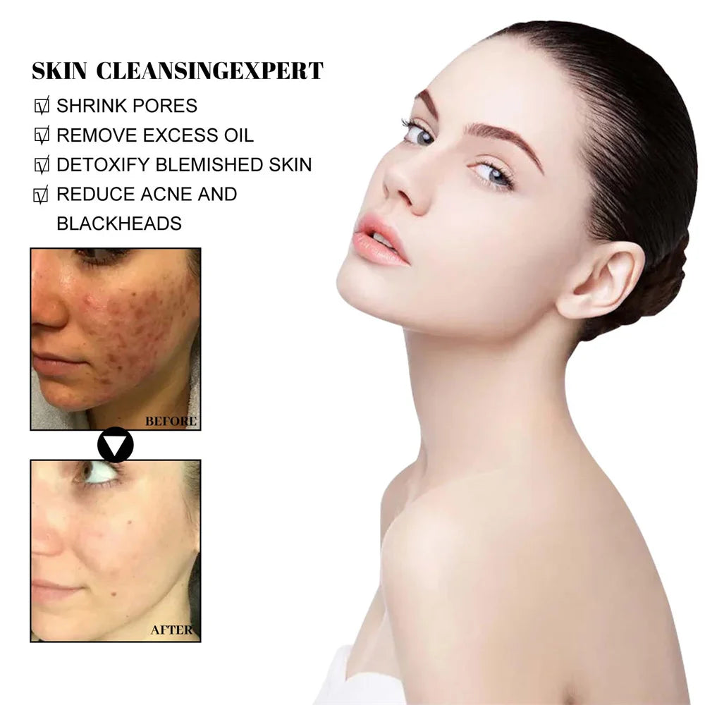 West & Month Blackhead Removal Mud Mask Deep Cleansing