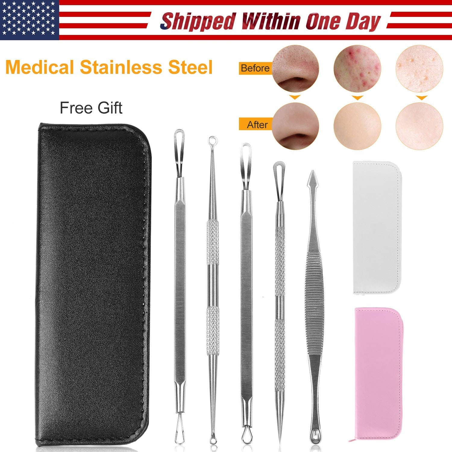 5-Piece Stainless Steel Blackhead Remover Acne Extractor Tool Set