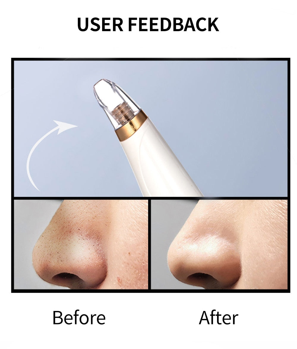 Blackhead Remover Vacuum Deep Pore Facial Cleansing Device Tool