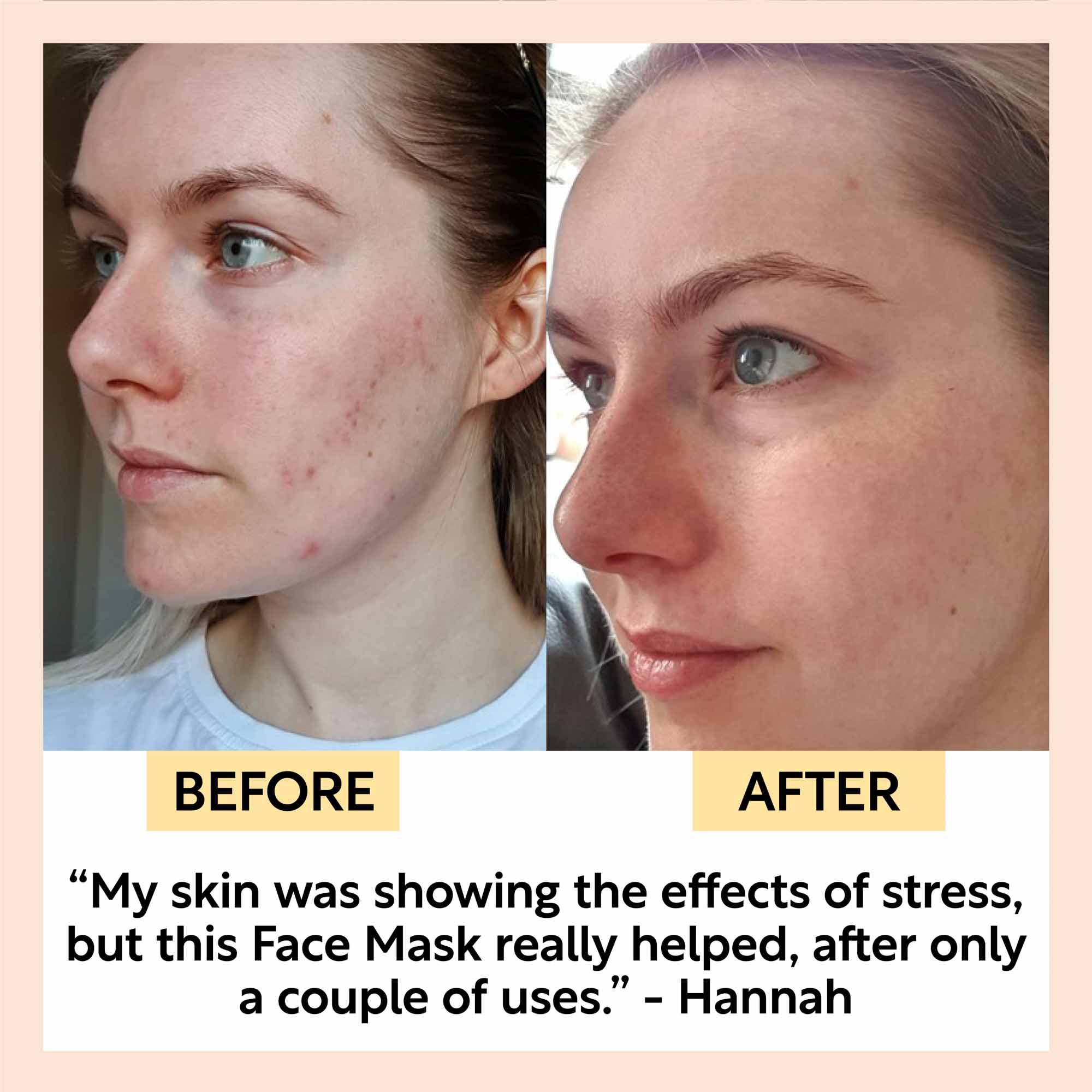 Clay Face Mask Deep Cleansing Pore Care Treatment