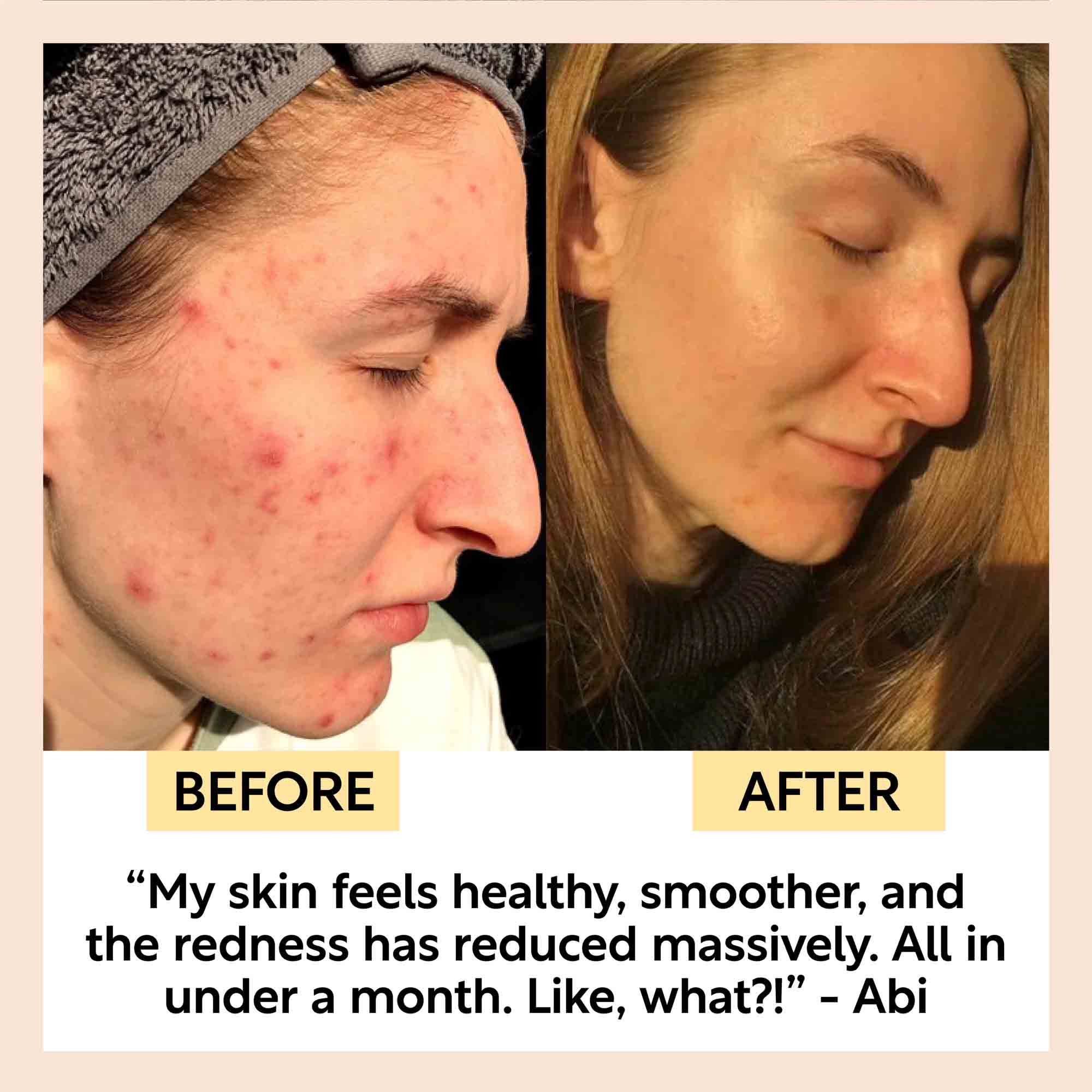 Clay Face Mask Deep Cleansing Pore Care Treatment