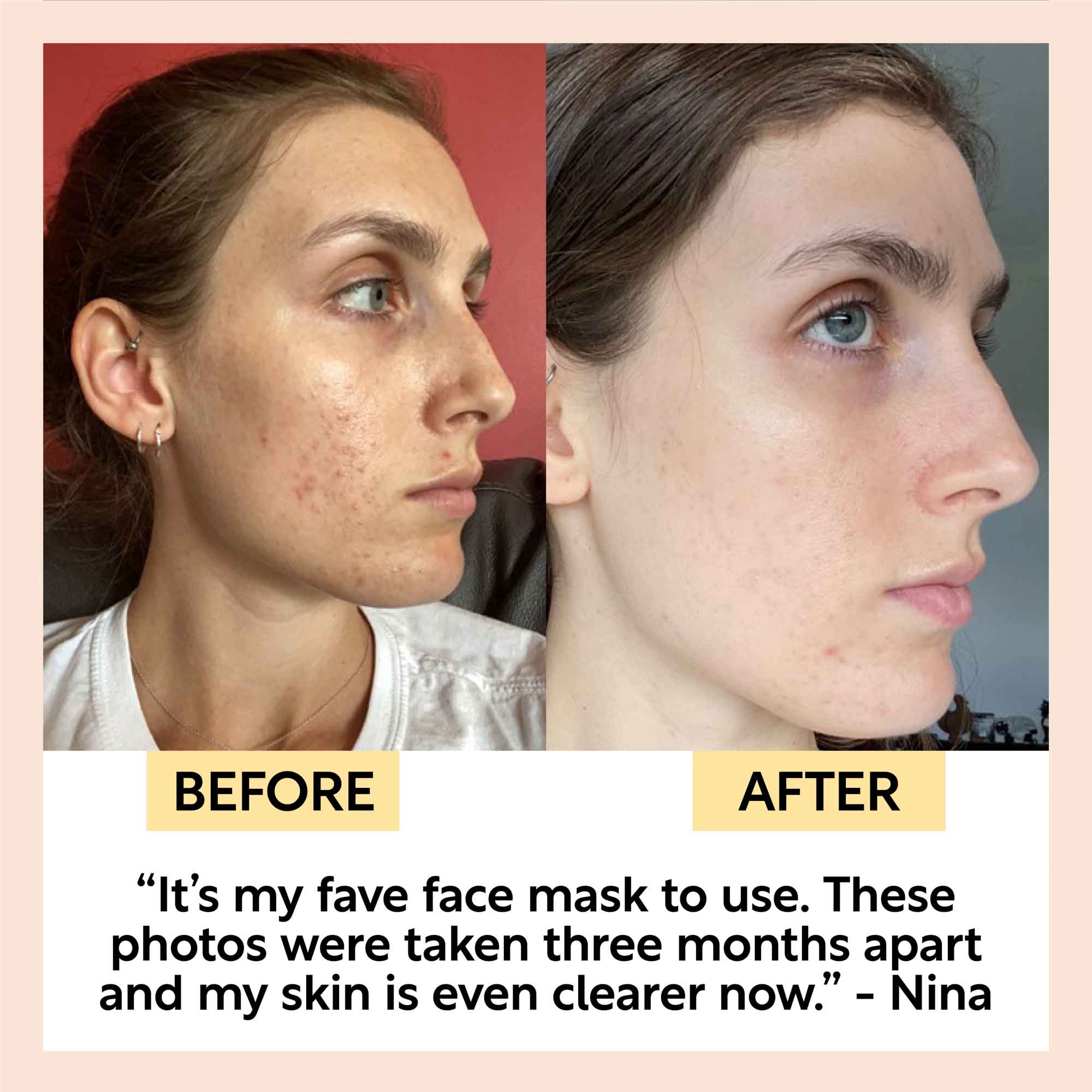 Clay Face Mask Deep Cleansing Pore Care Treatment