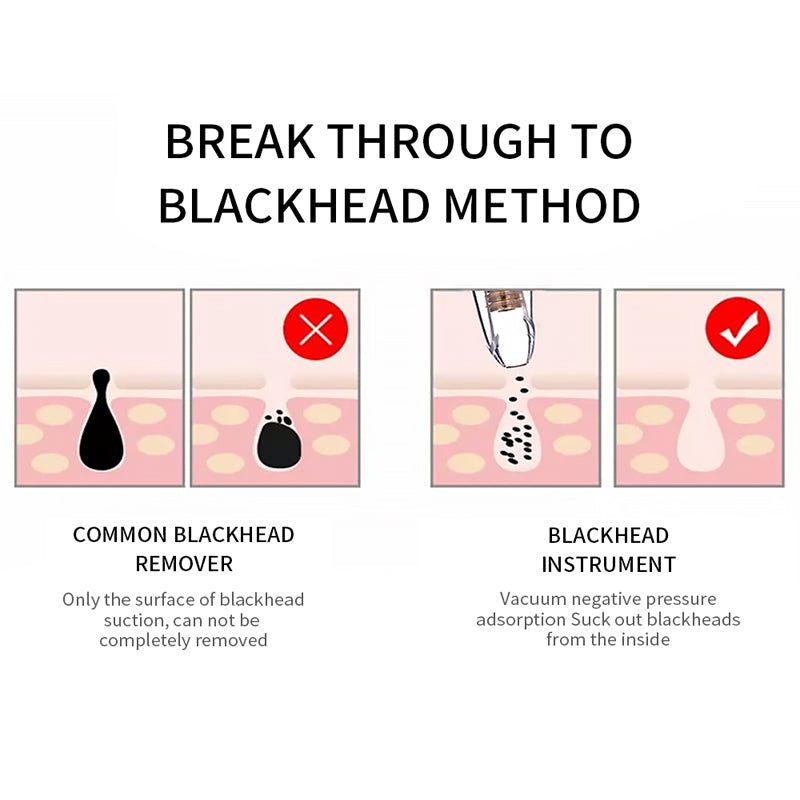 Blackhead Remover Vacuum Deep Pore Facial Cleansing Device Tool