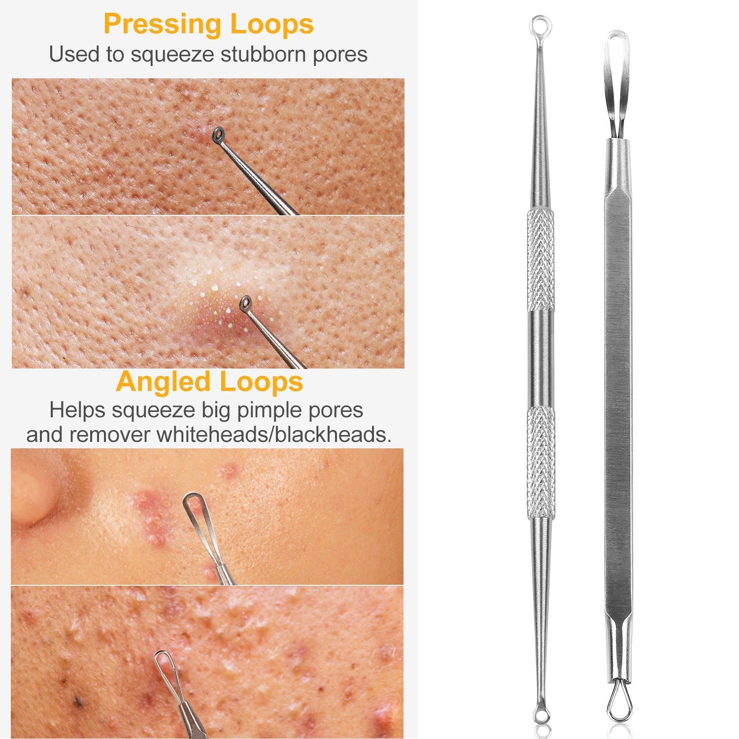 5-Piece Stainless Steel Blackhead Remover Acne Extractor Tool Set
