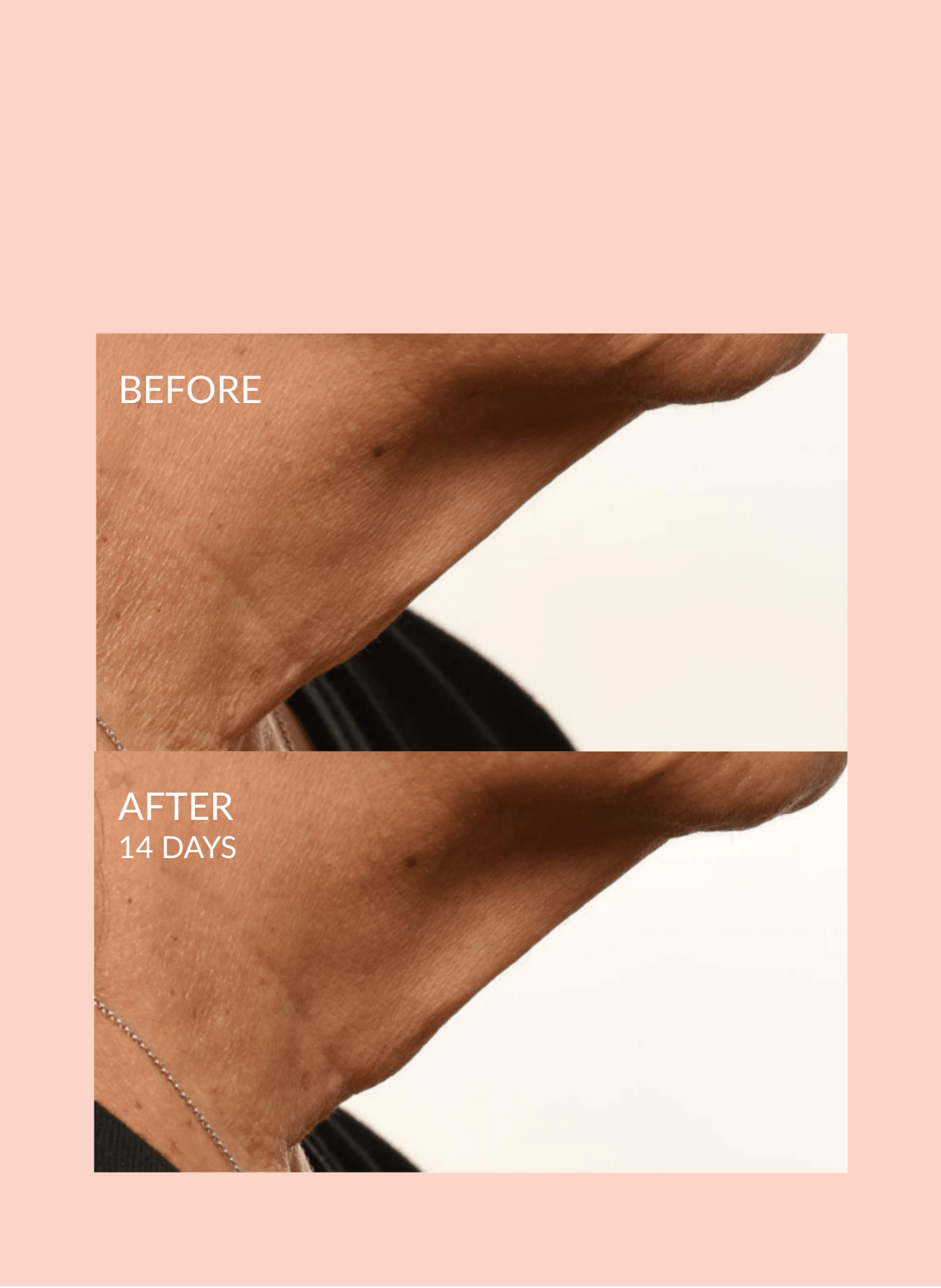Triple Lift Molecule Hydrating Facial Sheet Mask Treatment