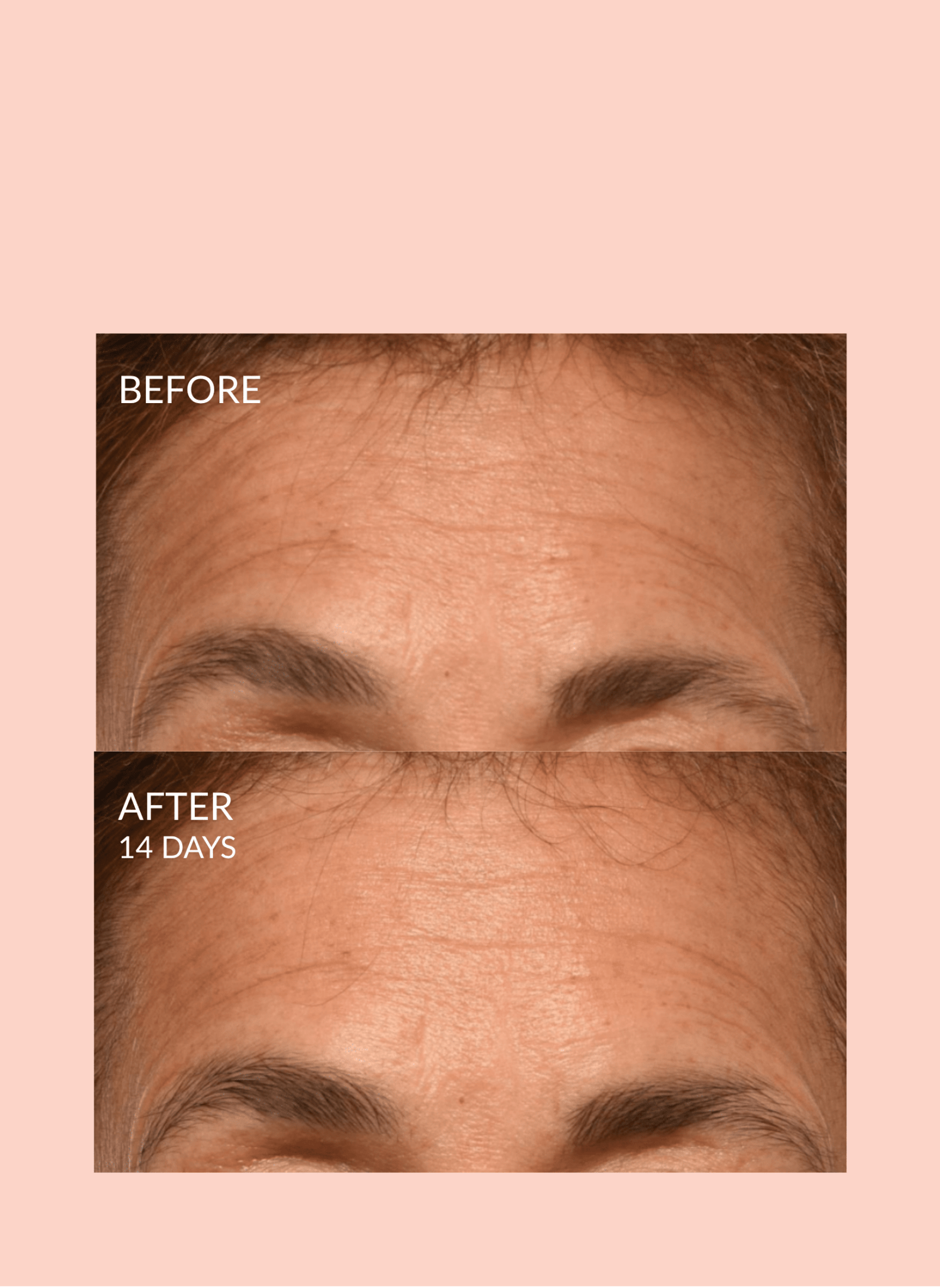 Triple Lift Molecule Hydrating Facial Sheet Mask Treatment